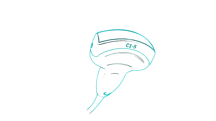 Regenerated Ultrasound Probe